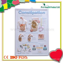 Constipation Patient Embossed Plastic Medical Chart